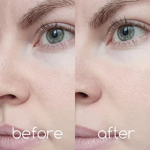 آمپول روشن‌کننده سنتلا Centella مدل Tone Brightening حجم 100 میل Skin1004 (Centella) - سنتلا